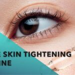 Rejuvenate Your Look: RF Eye Skin Tightening Machine Secrets